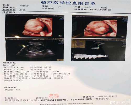北京代孕医院得花多少钱_30周早产儿存活率高吗