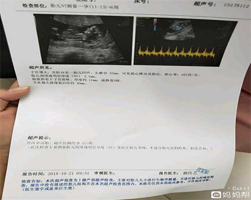 北京代孕电话_女人怀孕为什么会抽筋