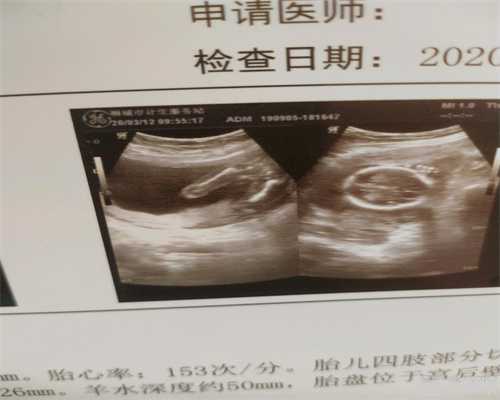 北京正规代孕医院什么价格_孕妇经常胃痛是怎么