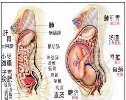 北京正规代孕包性别_一个月流产是什么症状