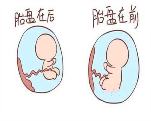 北京代孕中心生子_下肢静脉曲张注意事项