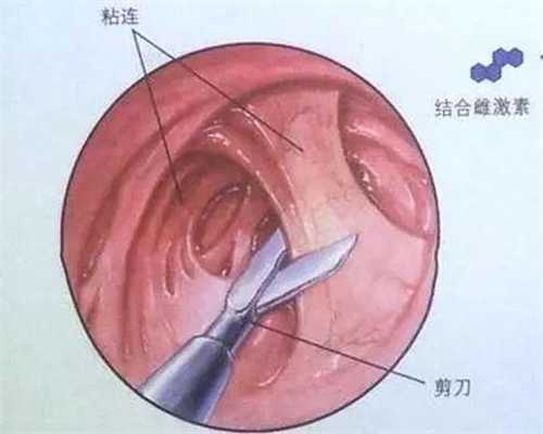 北京代孕医院服务哪家好_婴儿湿疹吃益生菌有用