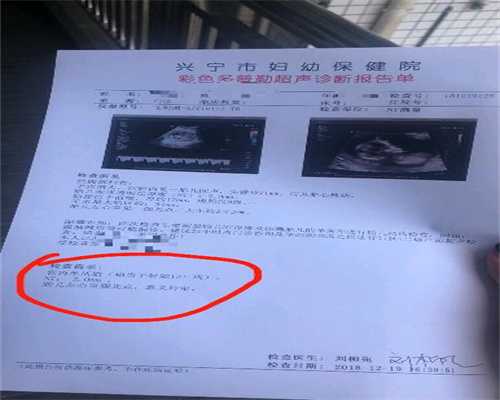 北京助孕产子价格是多少_婴儿睡着深吸很长的声