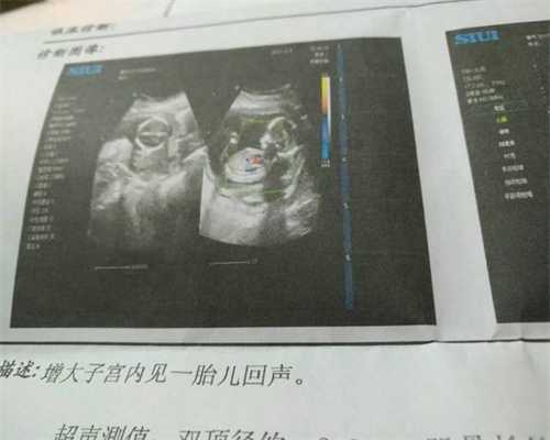 北京代怀孕花费_生完孩子憋不住尿怎么回事 产后