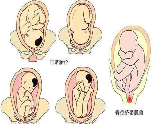 北京代孕北京中介_安全期做爱，拔出来，在外面射的，会怀孕吗