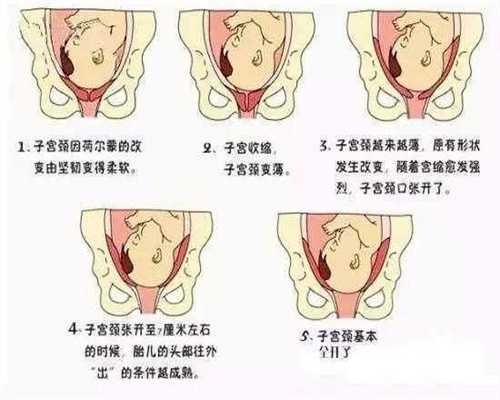 北京代孕需要多大年龄：产检对孕妇和胎儿都是重要的
