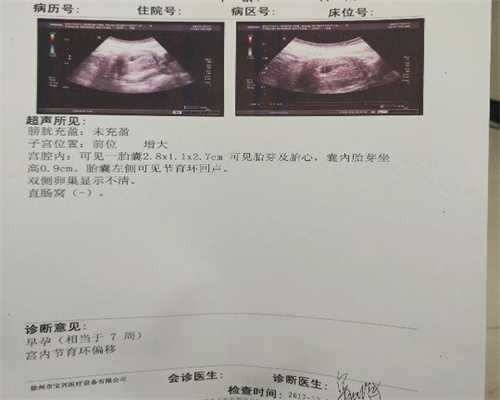 北京代孕哪家正规：腹部B超检查什么