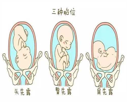 <b>北京代孕公司是真是假：乱用外用洗液危胁孕妈安全</b>