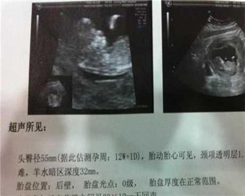 北京代孕费用：备孕不成功，那是你不知道这几个备孕成功率的小技巧