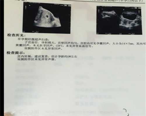 北京代孕孩子包男孩：北京代孕保定网站_北京代孕帮代生孩子