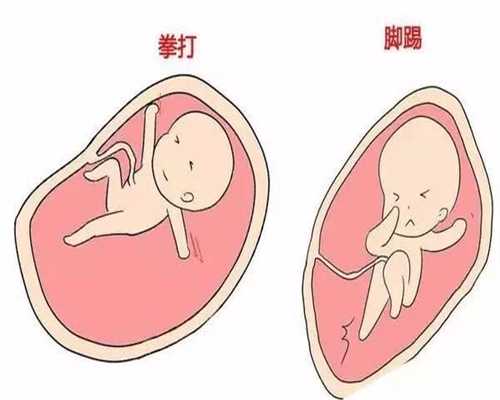 北京代孕2020：北京代孕大概多少钱_北京代孕价格多少费用