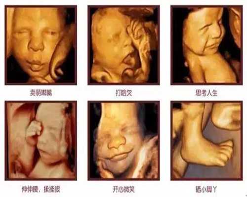 北京做代孕最厉害的医院：北京代孕中心_北京代怀孕在哪里