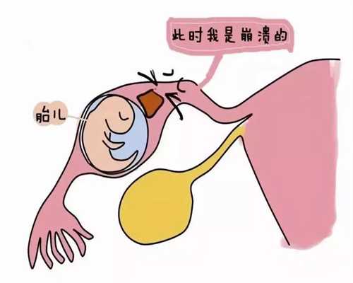 北京代孕生殖专家_北京代孕现在要多少钱