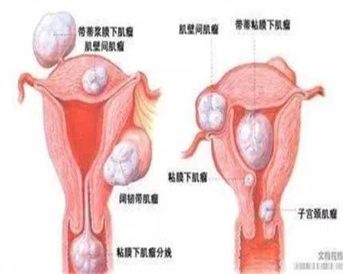北京代孕咨询-北京供卵选性别-最便宜北京代孕一个小孩多少钱