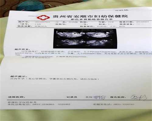 北京借腹生子~北京代孕双胞胎价格~孕妇检查脐血流要看什么指标