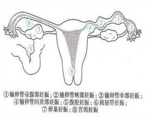 北京助孕-北京代孕如何操作-北京单身女人找代孕
