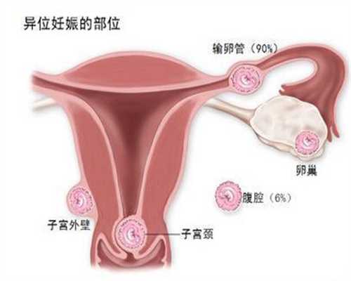 北京代生儿子,北京代孕哪里可以,北京代孕是人工受精吗