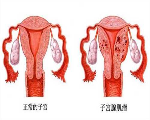 北京代孕能选性别吗_北京最好的代孕机构【北京用科学代孕不孕不育】