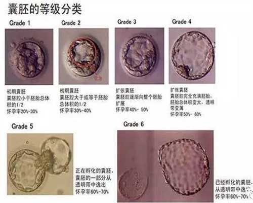 做北京试管婴儿流程详细大全，让你一键了解试管流程