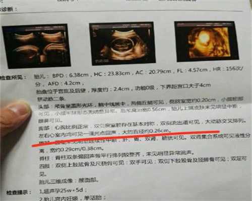 北京代妈：北京代怀孕一共多少钱啊_北京代孕网看福婴国际