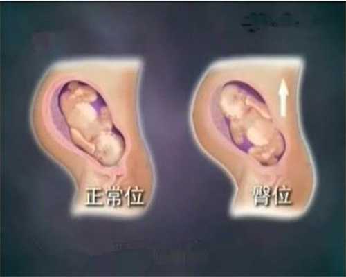北京价格低的代孕医院：北京代孕代孕网_2020年北京正规代孕网