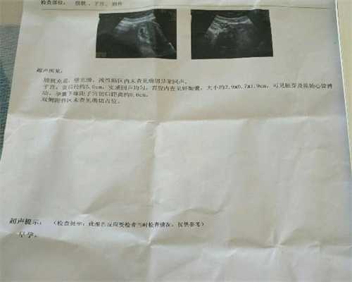 北京代孕合法的吗_北京市报告10例H7N9禽流感