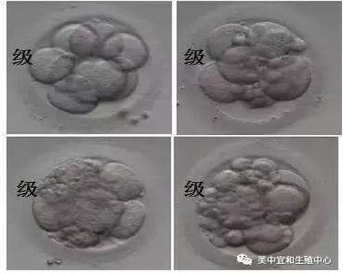 <b>北京三代试管包生儿子-代孕辅助生殖中心在哪里_北京市三所小学成首批食品安</b>
