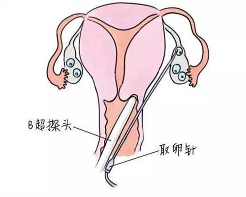 北京代孕产子中心哪家好-代孕包成功哪家优惠_一二三代试管分别指的是什么？