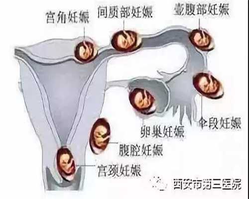 北京如何提升代孕的成功率-代孕那家价钱低_北京试管婴儿医院高龄备孕注意什