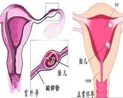 北京代孕生个孩子-找个年轻女人当代孕妈妈_「北京生殖中心医院」血精症是什